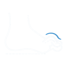 Illustration of a toe bent at the middle joint