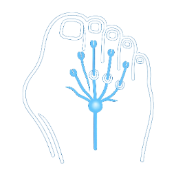 Illustration of a pinched nerve between the toes causing Morton’s neuroma