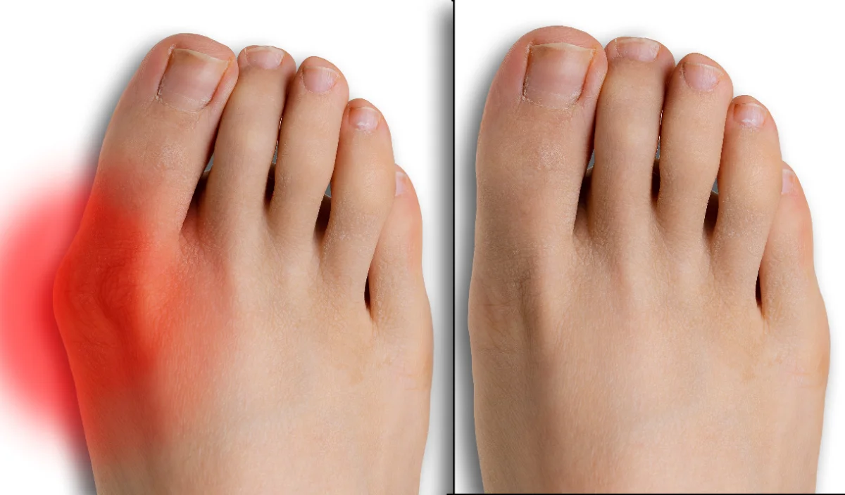 Clinical bunion evaluation in San Diego